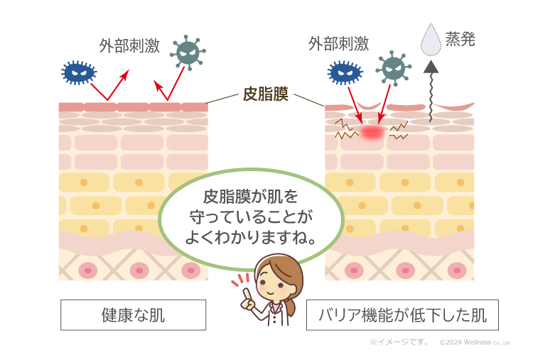 バリア機能が低下した肌は外部刺激を受けやすい。皮脂膜が肌を守っていることがよくわかりますね。