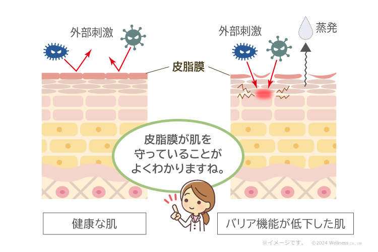 健康な肌とバリア機能が低下した肌の比較／皮脂膜が肌を守っていることがよくわかりますね