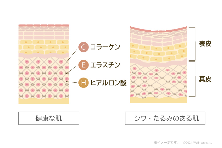 健康な肌とシワ・たるみのある肌の比較