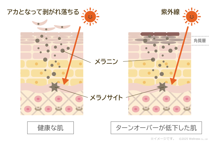 健康な肌とターンオーバーが低下した肌の比較／健康な肌はメラニンがアカとなって剥がれ落ちる